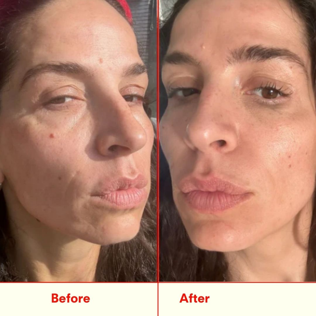 Before and after face comparison