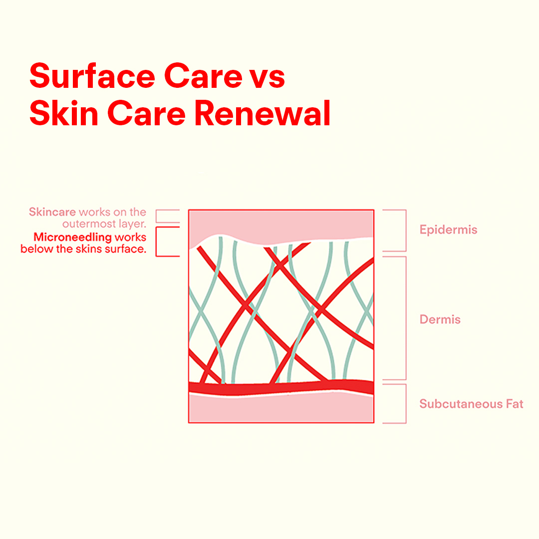 What Skincare is Actually Treating and Why Skin Tools Change the Game!