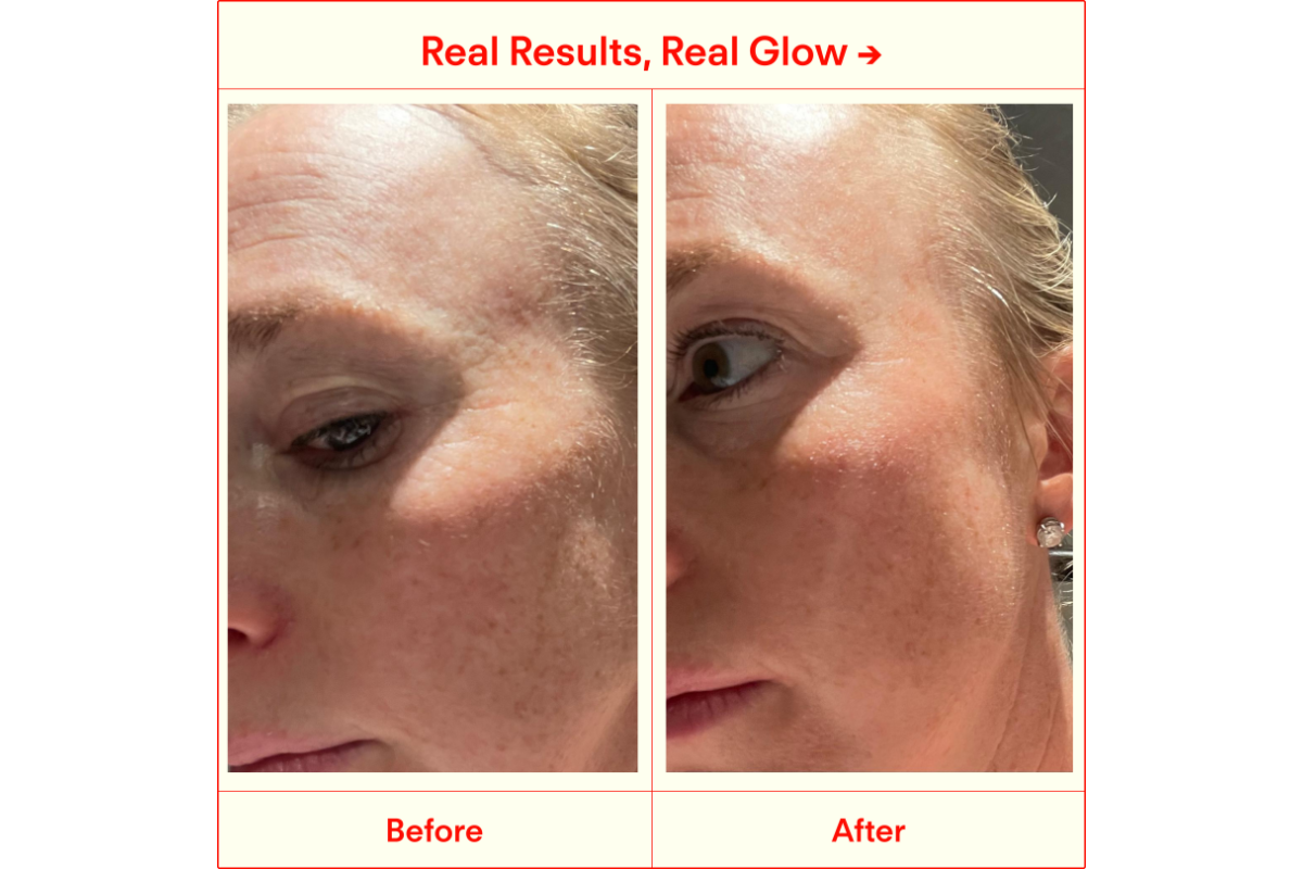 The Science of Skin Renewal
