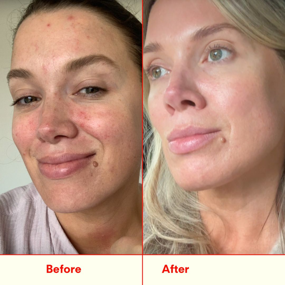 Before and after face comparison